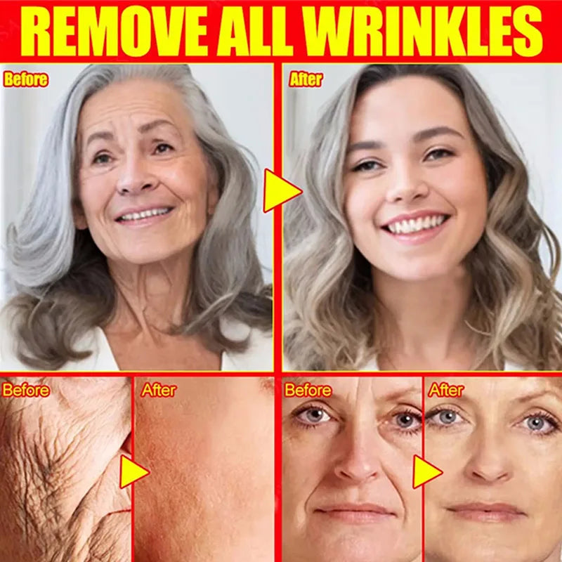 Retinol Wrinkle Remover Face Set Instant Firming Lifting Anti-Aging Serum Fade Fine Lines Whitening Korean Skin Care Products