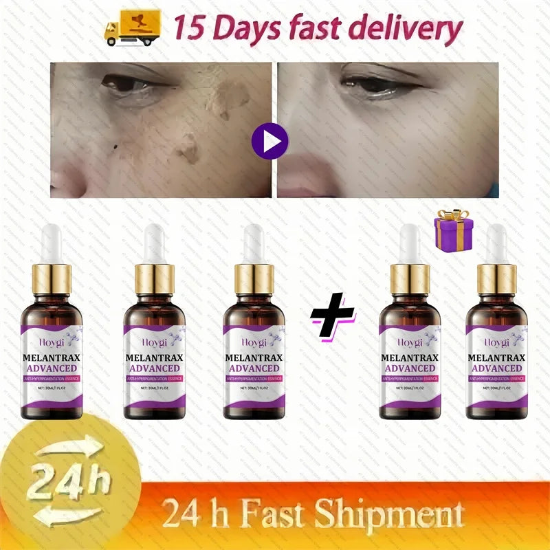 Dark Spots Remover Whitening Serum Face Freckle Melanin Correcting Anti Pigmentation Brighten Beauty Korean Day Night Skin Care Buy 3 Get 2 Free