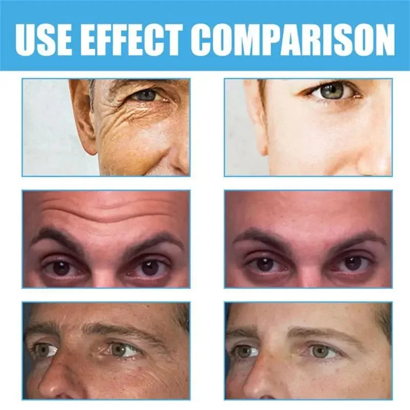 Retinol Anti-wrinkle Cream For Men Collagen Anti-Aging Removal Face Neck Wrinkle Efficient Moisturizing Firming Korean Skin Care