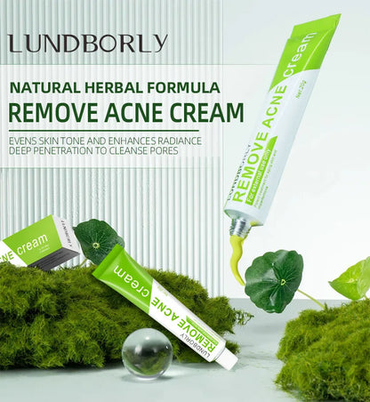 Natural Herbal Face Cream 20g Acne Cream with Salicylic Acid Oil Control Moisturizing Fading Acne Marks Gentle Non Irritating