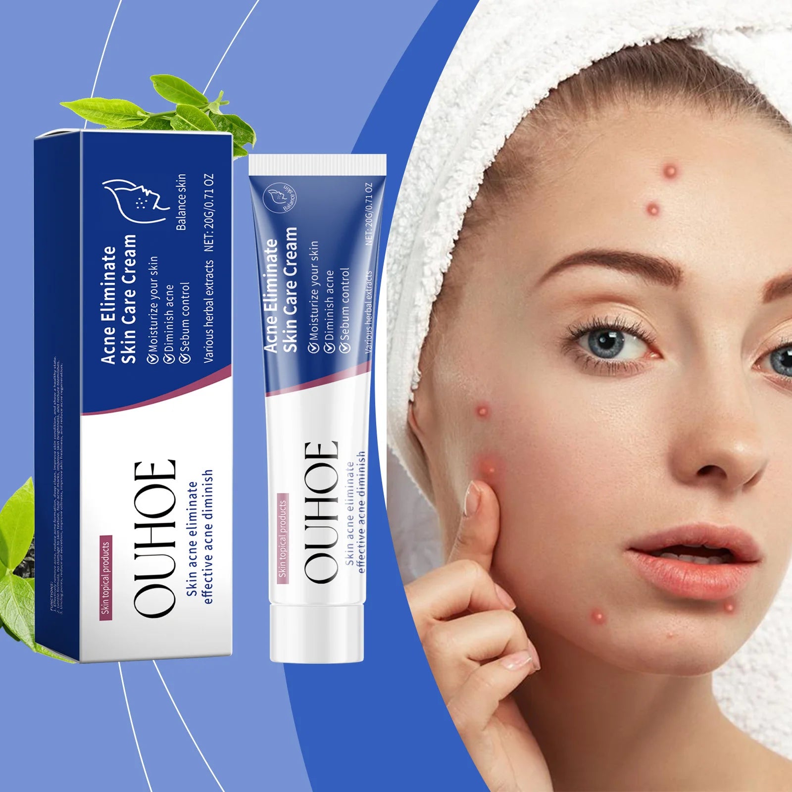 Pimple Acne Treatment Face Cream Nourish Balance Oil Control Refreshing Repairing Pimple Remover Acne Removing Cleansing Cream