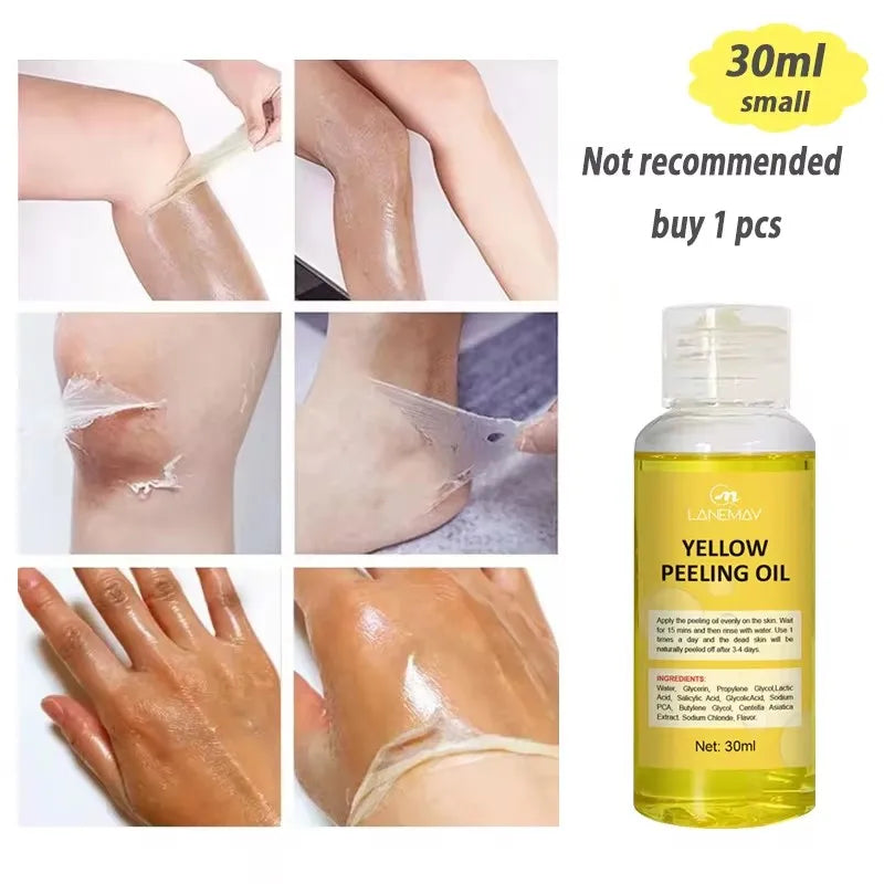 Strong Yellow Peeling Oil Bleach Dark Skin Whiten Lotion Lighten Body Elbow Knee Hand Exfoliate Dead Skin Nourish Even Skin Tone 30ml