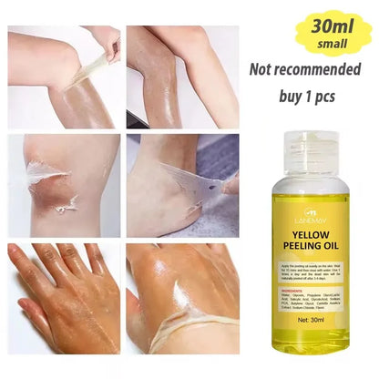 Strong Yellow Peeling Oil Bleach Dark Skin Whiten Lotion Lighten Body Elbow Knee Hand Exfoliate Dead Skin Nourish Even Skin Tone 30ml