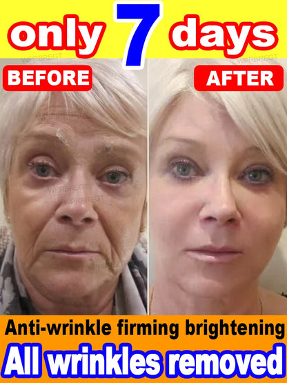 No wrinkles, 20 years younger
