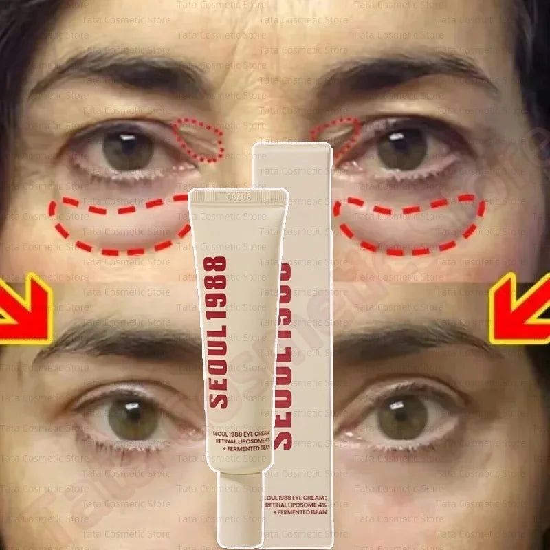 SEOUL 1988 Eye Cream Niacinamide 2% Retinal Acid Ginseng Serum Lighten Fine Lines Firming Pores Brightening Face Korean Skincare