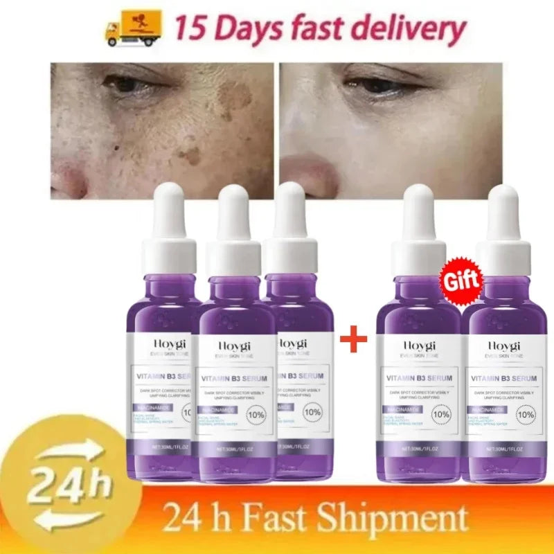 Dark Spots Remover Whitening Serum Face Freckle Melanin Correcting Anti Pigmentation Brighten Beauty Korean Day Night Skin Care Buy 3 get 2 free