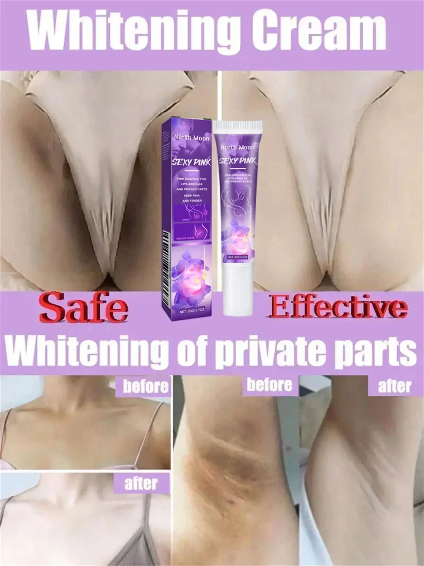 Nicotinamide Brightening Cream For Dark Skin Effective Lighten Thigh Inner Bleach Remove Melanin Private Parts Brighten Cream