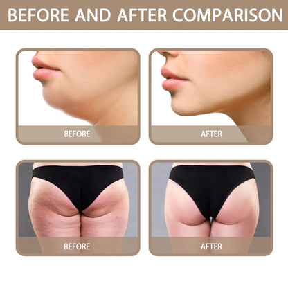 South Moon Shaping Body Cream Anti-cellulite Chin Firming Ginger Slim Gel Weight Lose Fat Burning Slimming Hot Fat Burning Cream