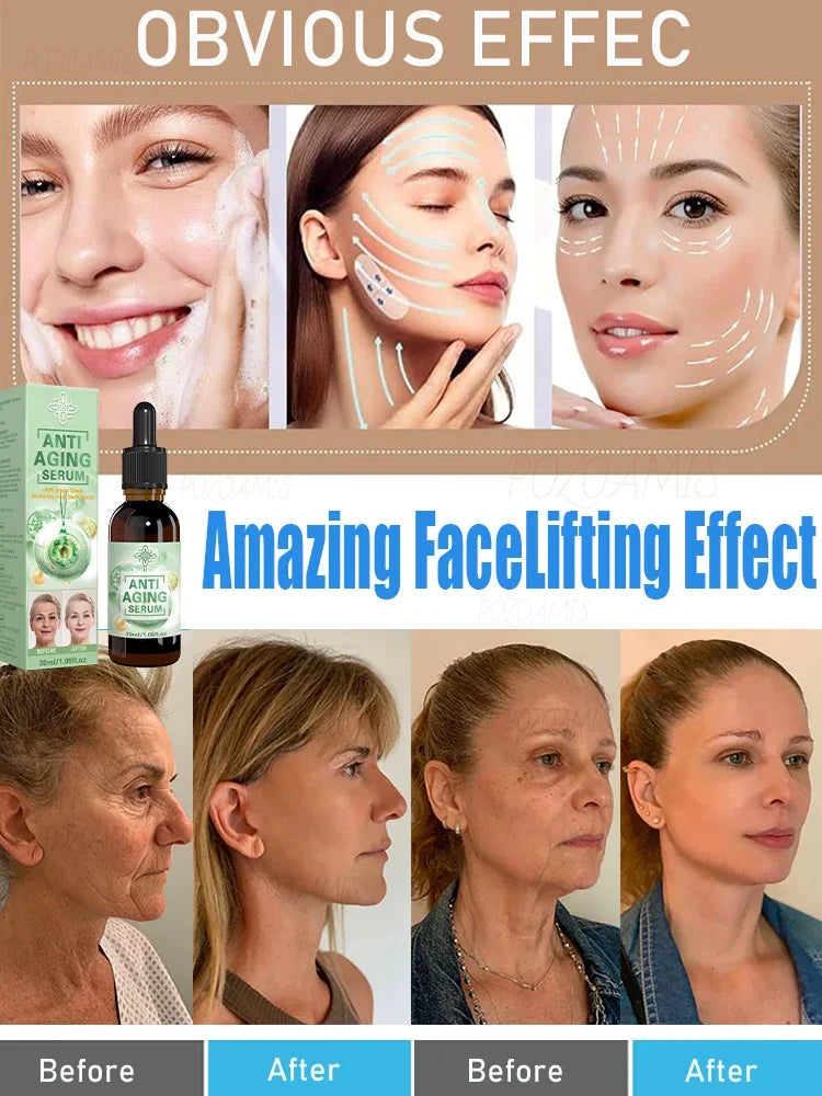 wrinkles disappear become beautiful now