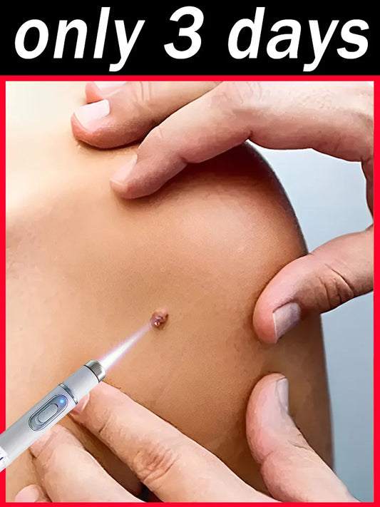 1st ᵍᵉⁿᵉʳᵃᵗⁱᵒⁿ ᵘᵖᵍʳᵃᵈᵉᵈ wᵃʳᵗ ⸴ ʳᵉpᵃⁱʳ wᵃʳᵗˢ ʳᵒoᵗ ⸴ ᑫᵘⁱᶜᵏˡʸ Badiee Stylez