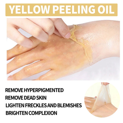 Strong Yellow Peeling Oil Bleach Dark Skin Whiten Lotion Lighten Body Elbow Knee Hand Exfoliate Dead Skin Nourish Even Skin Tone