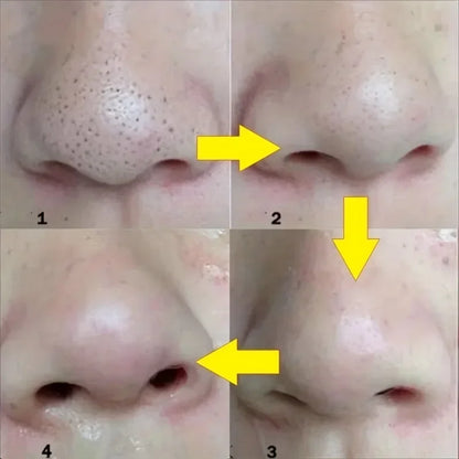 15pcs Blackhead Nose Strips Deep Cleansing Nasal Spot Facial Dot Stickers Nose Mask Shill For Acne & Black Head - Dropship