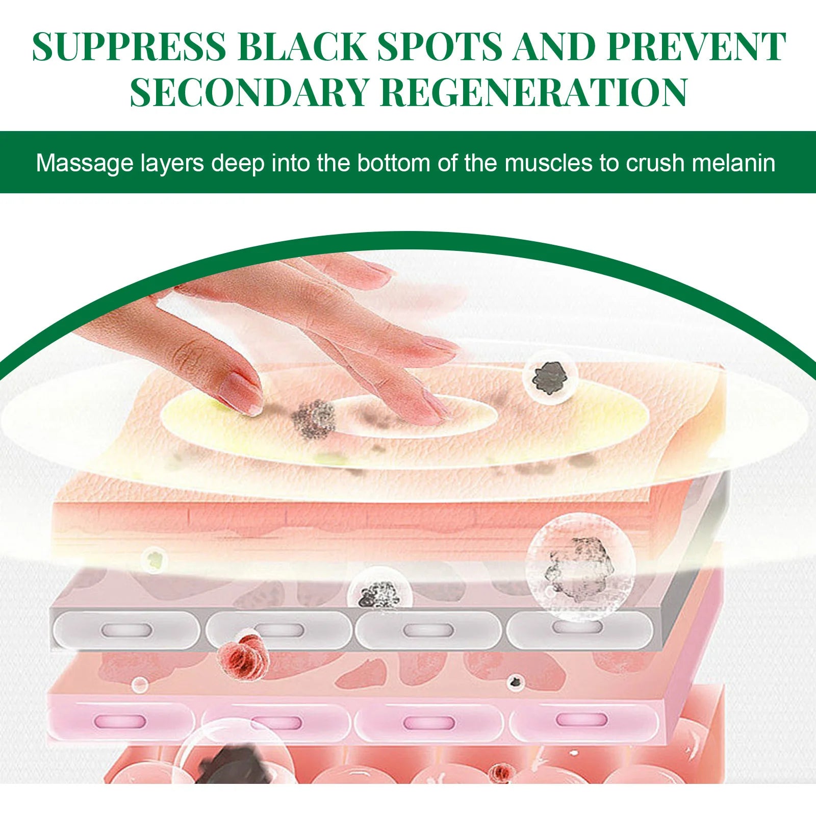 Nicotinamide Whitening Freckles Face Cream Remove Melasma Dark Spots Corrector Fade Melanin Acne Anti-Aging Brighten Skin Care