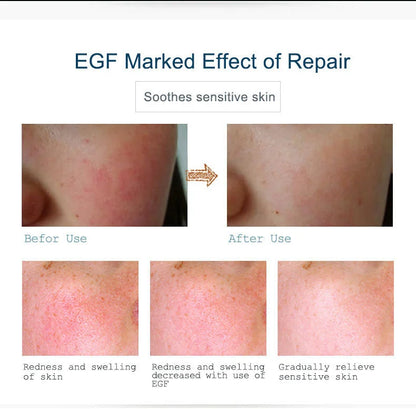 ARTISCARE EGF Face Serum for Skin Care Moisturizing Rejuvenation Cream Facial Oil Control Shrink Pores Essence