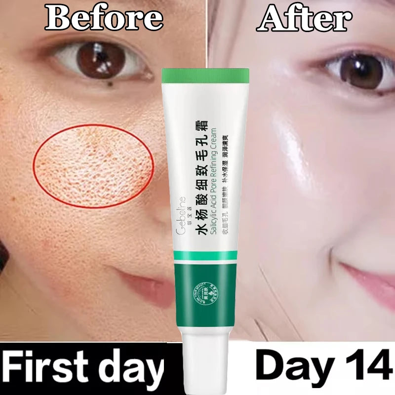 Salicylic Acid Pore Shrinking Cream Eliminate Large Pores Serum Remove Blackhead Acne Repairing Tightening Skin Care Cosmetics