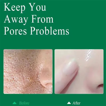 Salicylic Acid Pore Shrinking Cream Eliminate Large Pores Serum Remove Blackhead Acne Repairing Tightening Skin Care Cosmetics