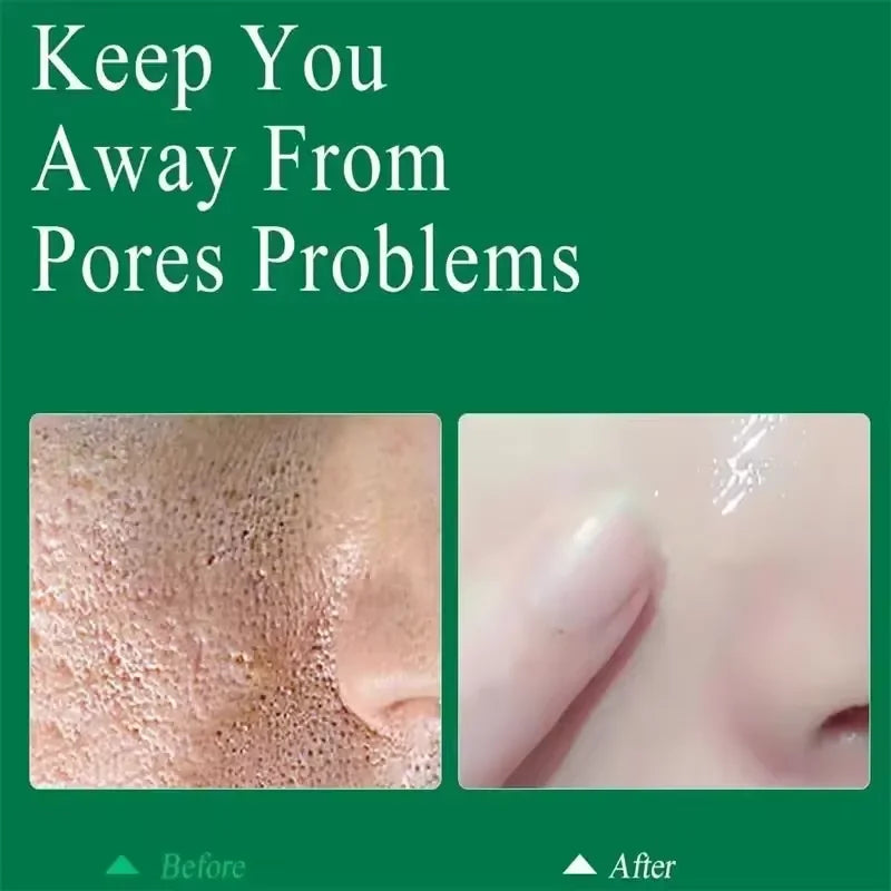 Salicylic Acid Pore Shrinking Cream Eliminate Large Pores Serum Remove Blackhead Acne Repairing Tightening Skin Care Cosmetics