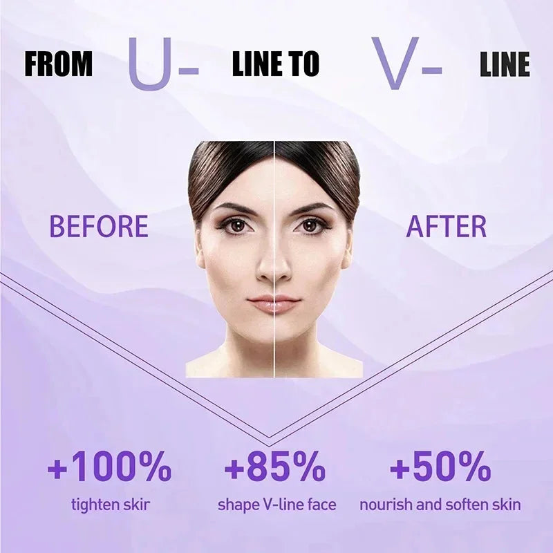 V Face Slimming Cream Enzyme Massage Cream Firm Face Lift To Remove Masseter Double Chin To Lighten Neck Line Fat Burning Cream