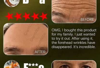 The effect is very good. The wrinkles are gone.