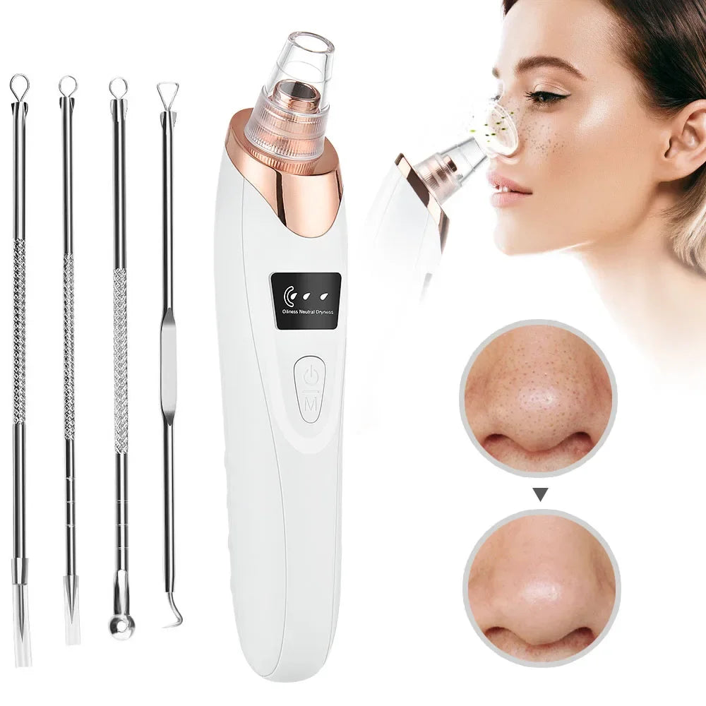Okayso Blackhead Remover with Acne Needle Vacuum Pore Cleaner Black Pimple Blemish Remove for Face&Nose Skin Care Tool Kit