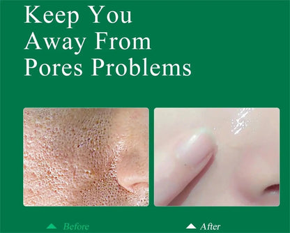 Salicylic Acid Pore Shrinking Cream Reduce Large Pore Tighten Refining Face Repair Rough Dull Pore Brighten Moisturize Skin Care