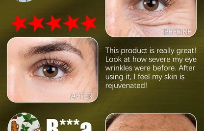 The effect is very good. The wrinkles are gone.