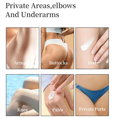 Nicotinamide Brightening Cream For Dark Skin Effective Lighten Thigh Inner Bleach Remove Melanin Private Parts Brighten Cream