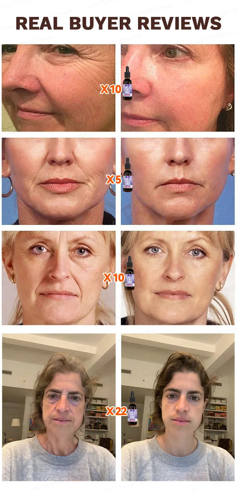 No wrinkles, 20 years younger