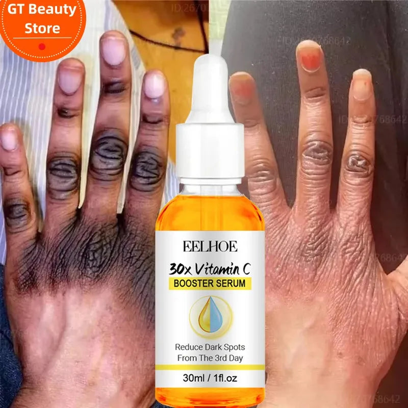 Dark Knuckles Fast Brighten Serum Elbows Hand Knuckle Brightening Serum Knee Black Skin Quickly Lighten Stains Remover Essence