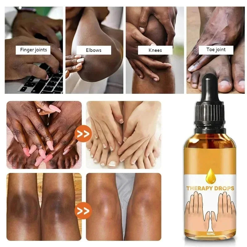Dark Knuckles Fast Brighten Serum Elbows Hands Knee Armpits Brightening Serum Clarify Black Skin Lighten Stains Remover Essence