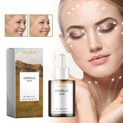 Korean Centella Asiatica Face Serum Shrink Pores Smoothing Rejuvenation Skin Brighten Whitening Cream Facial Moisturizing 30 ml Face Serum