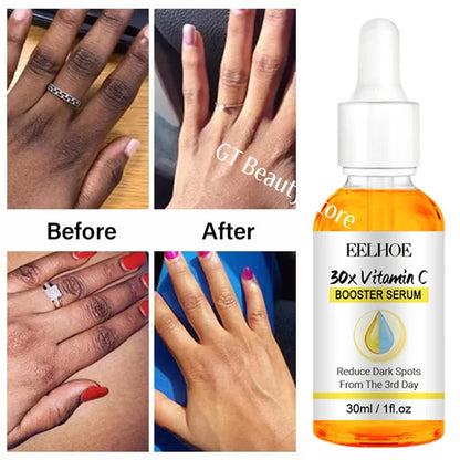 Dark Knuckles Fast Brighten Serum Elbows Hand Knuckle Brightening Serum Knee Black Skin Quickly Lighten Stains Remover Essence A