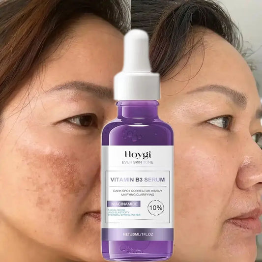 Powerful Dark Spots Remover Freckle Whitening Serum Melanin Correcting Anti Pigmentation Brighten Korean Day Night Facial Care Default Title