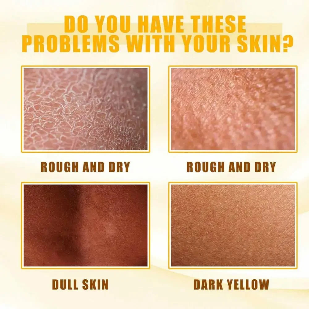 Body Care Exfoliating Yellow Peeling Oil 100% Organic Bleaching Dark Skin Serum Dark Knuckles Fast Whitening Cosmetics