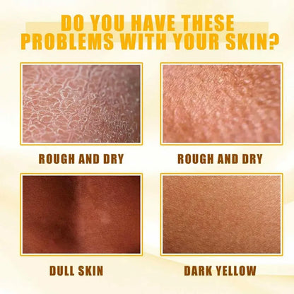 Body Care Exfoliating Yellow Peeling Oil 100% Organic Bleaching Dark Skin Serum Dark Knuckles Fast Whitening Cosmetics