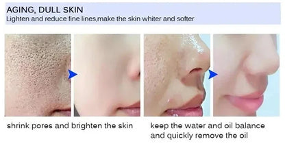 Salicylic Acid Pore Shrinking Cream Eliminate Large Pores Serum Remove Blackhead Acne Repairing Tightening Skin Care Cosmetics
