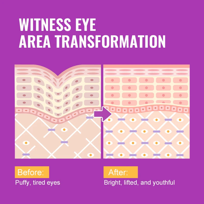 Eye Essence Serum Removal Dark Circles Eyebags Deep Hydration & Anti-Wrinkle Strengthens Contour Skin Barrier Care Eyes Serum