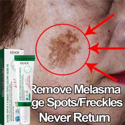 Nicotinamide Whitening Freckles Face Cream Remove Melasma Dark Spots Corrector Fade Melanin Acne Anti-Aging Brighten Skin Care