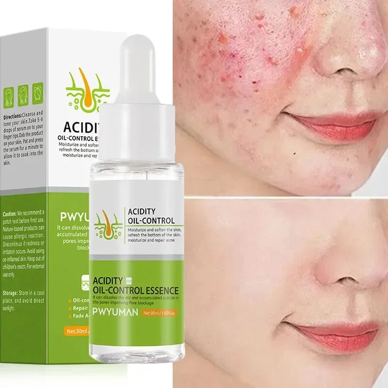 Salicylic Acid Pore Shrinking Cream Eliminate Large Pores Serum Remove Blackhead Acne Repairing Tightening Skin Care Cosmetics