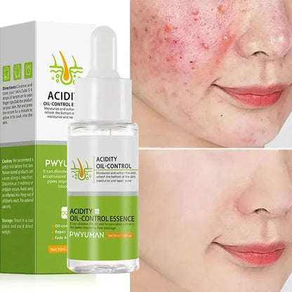 Salicylic Acid Pore Shrinking Cream Eliminate Large Pores Serum Remove Blackhead Acne Repairing Tightening Skin Care Cosmetics