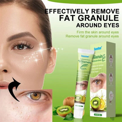 Fat Granules Remover Eye Cream Skin Care Products
