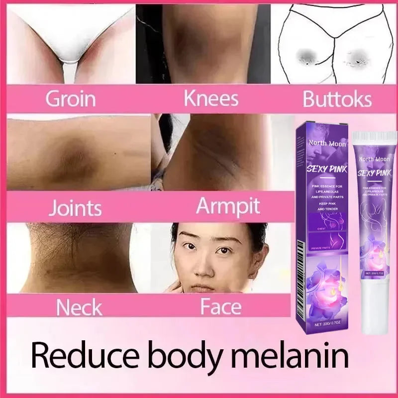 Nicotinamide Brightening Cream For Dark Skin Effective Lighten Thigh Inner Bleach Remove Melanin Private Parts Brighten Cream