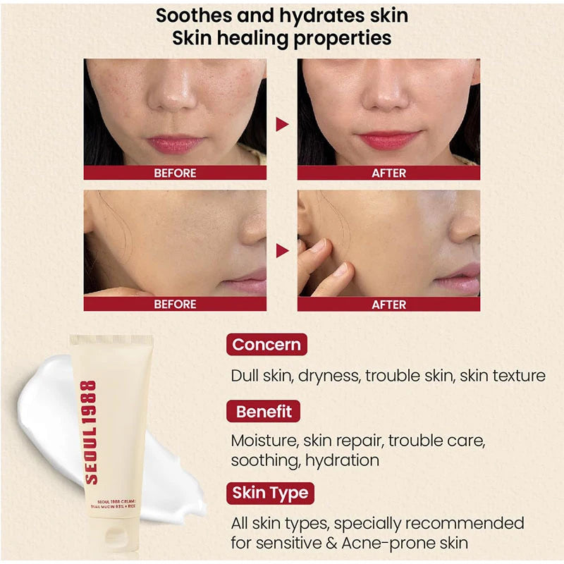 Seoul 1988 100ml Retinal Serum Brand Ginseng Eye Cream Closed Comedones Brighten Face Sunscreen Moisturize Korean Care Essence