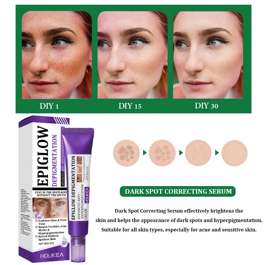 Whitening Freckle Cream Melasma Dark Spots Pigmentation Removal Product Fade Stain Melanin Fast Repair Brighten Korean Skin Care