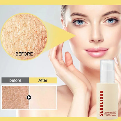 SEOUL 1988 Eye Cream Niacinamide 2% Retinal Acid Ginseng Serum Lighten Fine Lines Firming Pores Brightening Face Korean Skincare