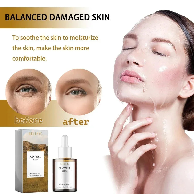 Korean Centella Asiatica Face Serum Shrink Pores Smoothing Rejuvenation Skin Brighten Whitening Cream Facial Moisturizing 30 ml