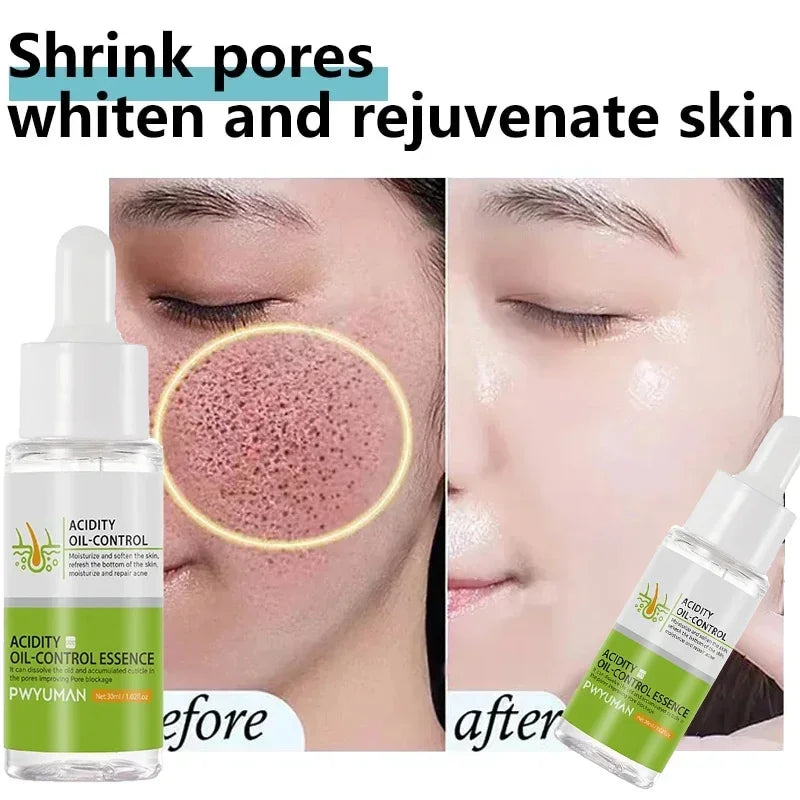 Salicylic Acid Pore Shrinking Cream Eliminate Large Pores Serum Remove Blackhead Acne Repairing Tightening Skin Care Cosmetics