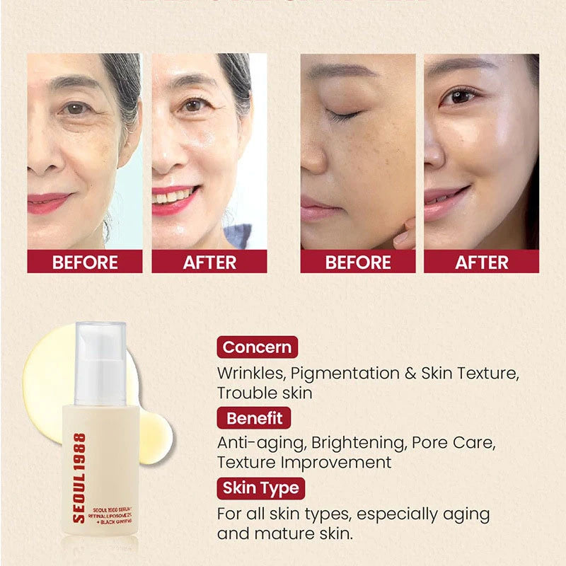 Seoul 1988 100ml Retinal Serum Brand Ginseng Eye Cream Closed Comedones Brighten Face Sunscreen Moisturize Korean Care Essence
