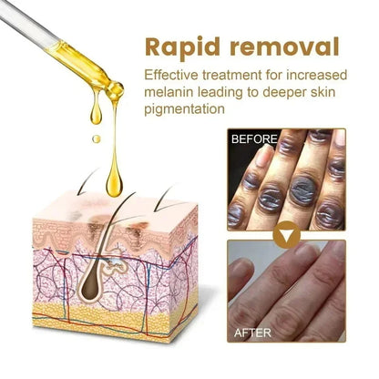 Dark Knuckles Fast Brighten Serum Elbows Hands Knee Armpits Brightening Serum Clarify Black Skin Lighten Stains Remover Essence