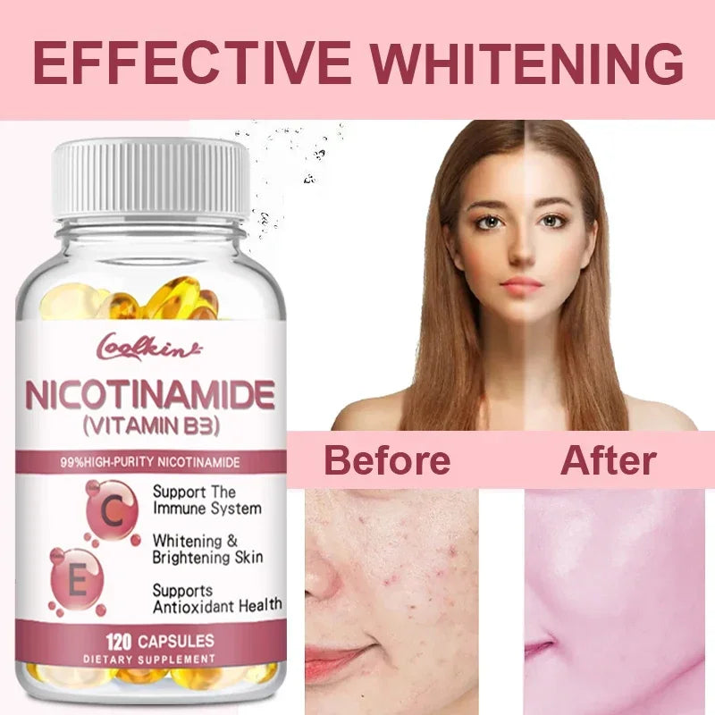 Niacinamide Whitening Capsules - with Vitamin B3, Supports Skin and Immune Health, Reduces Wrinkles and Fights Aging, Non-GMO